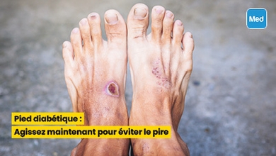 Pied diabétique : Agissez maintenant pour éviter le pire
