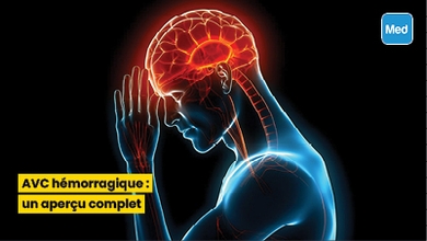 AVC hémorragique : un aperçu complet