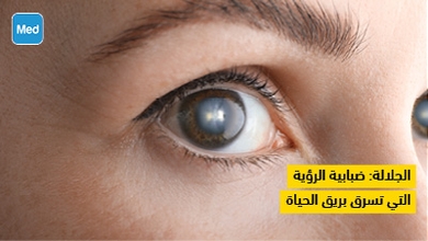 الجلالة: ضبابية الرؤية التي تسرق بريق الحياة