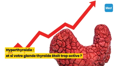 Hyperthyroïdie : et si votre glande thyroïde était trop active ?