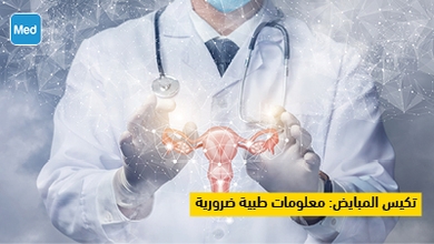 تكيس المبايض: معلومات طبية ضرورية 