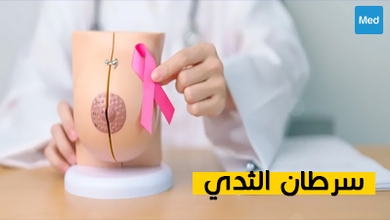 فهم شامل لسرطان الثدي: الأعراض والتشخيص والعلاج