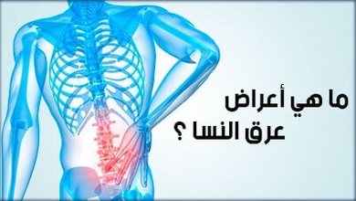 ما هي أعراض عرق النسا  