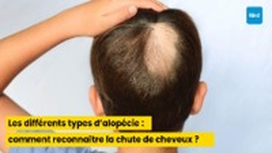 Les différents types d’alopécie : comment reconnaître la chute de cheveux ?