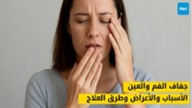 جفاف الفم والعين: الأسباب والأعراض وطرق العلاج