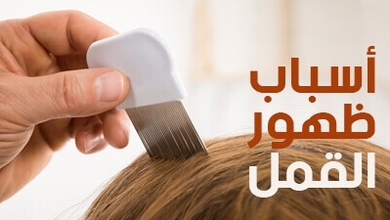 أسباب ظهور القمل