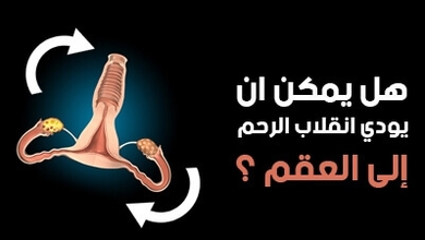هل يمكن أن يؤدي انقلاب الرحم إلى العقم