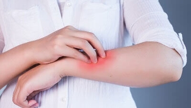 Antifongiques naturels