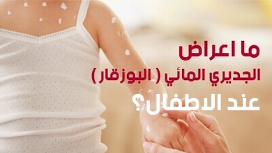  ما أعراض الجديري المائي عند الأطفال؟  ( البوزقار )