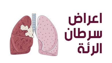 اعراض سرطان الرئة