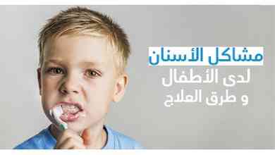مشاكل الأسنان لدى الأطفال و طرق العلاج