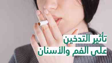 تأثير التّدخين على الفم والأسنان 