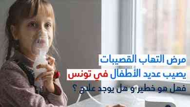 مرض التهاب القصيبات يصيب عديد الأطفال في تونس فهل هو خطير و هل يوجد علاج ؟