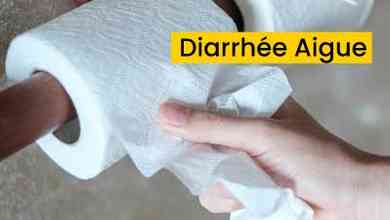 Diarrhée Aigue