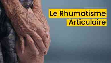 le Rhumatisme Articulaire