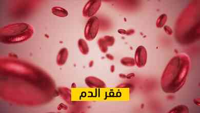 فقر الدم