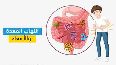 التهاب المعدة والأمعاء