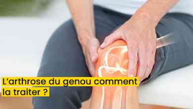 L’arthrose du genou comment la traiter ?