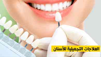 العلاجات التجميلية للأسنان