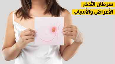 سرطان الثدي: الأعراض والأسباب