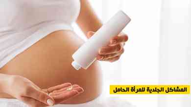 المشاكل الجلدية للمرأة الحامل