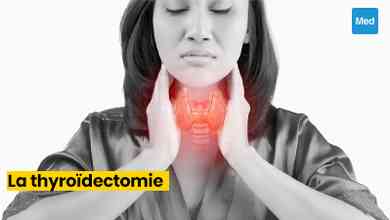 La Thyroïdectomie : Comprendre l