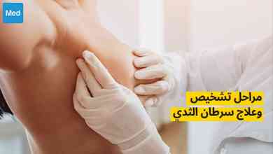 مراحل تشخيص وعلاج سرطان الثدي