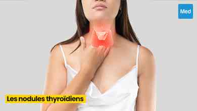 Comprendre les Nodules Thyroïdiens : Symptômes, Causes et Conseils de Gestion