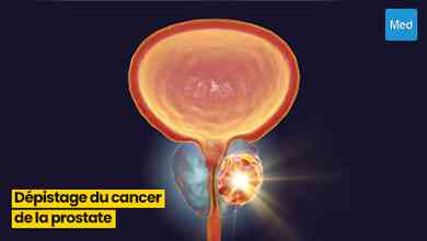 Comprendre le Dépistage du Cancer de la Prostate : Informations Essentielles pour les Hommes