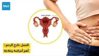 الحمل خارج الرحم: أهم أعراضه وعلاجه