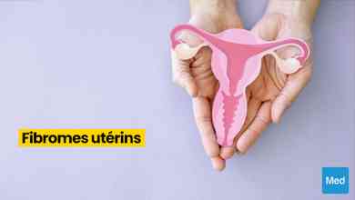 Fibromes utérins : définition, symptômes, diagnostic et traitement