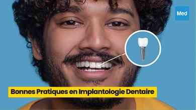 Bonnes Pratiques en Implantologie Dentaire