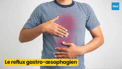 Reflux gastro-œsophagien (RGO) : causes, symptômes et traitement