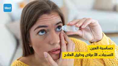حساسية العين: التسببات، الأعراض وطرق العلاج