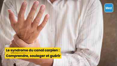 Le syndrome du canal carpien : Comprendre, soulager et guérir