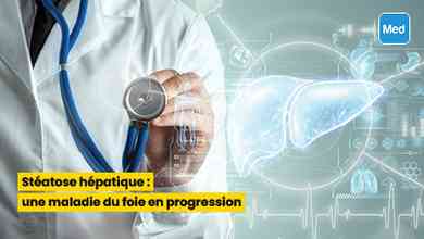 Stéatose hépatique : une maladie du foie en progression