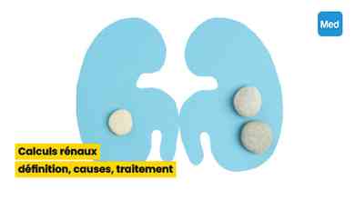 Calculs rénaux : définition, causes, traitement
