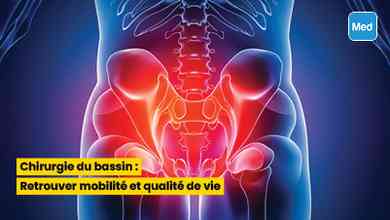 Chirurgie du bassin : Retrouver mobilité et qualité de vie