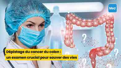 Dépistage du cancer du colon : un examen crucial pour sauver des vies