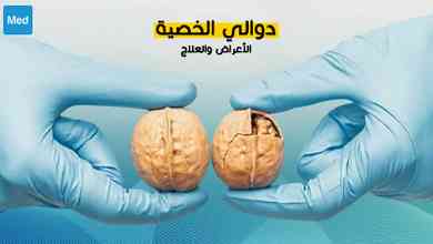 دوالي الخصية : الأعراض والعلاج
