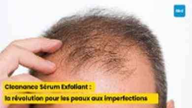 Comprendre la chute de cheveux : causes, conséquences et solutions efficaces