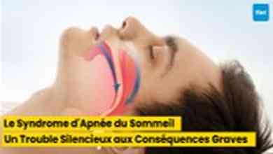 Le Syndrome d