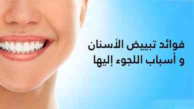 فوائد تبييض الأسنان و أسباب اللجوء إليها 