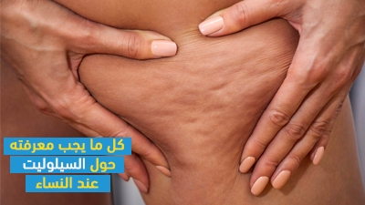 كل ما يجب معرفته حول السيلوليت عند النساء