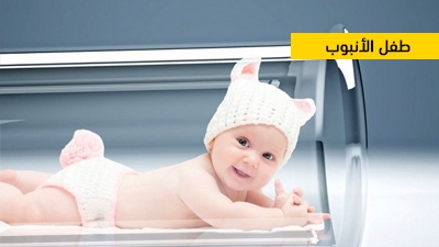 طفل الأنبوب