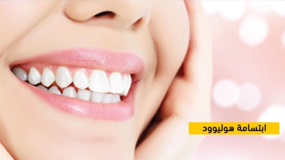 ابتسامة هوليوود