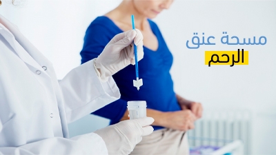 مسحة عنق الرحم