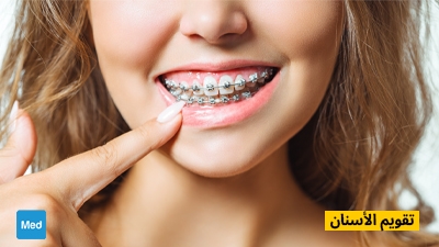 تقويم الأسنان
