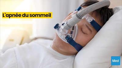Comprendre l'apnée du sommeil : Le souffle qui se brise dans la nuit