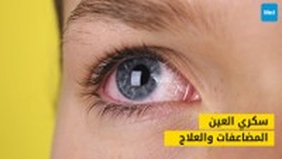 سكري العين: دليلك الشامل لفهم المضاعفات والعلاج